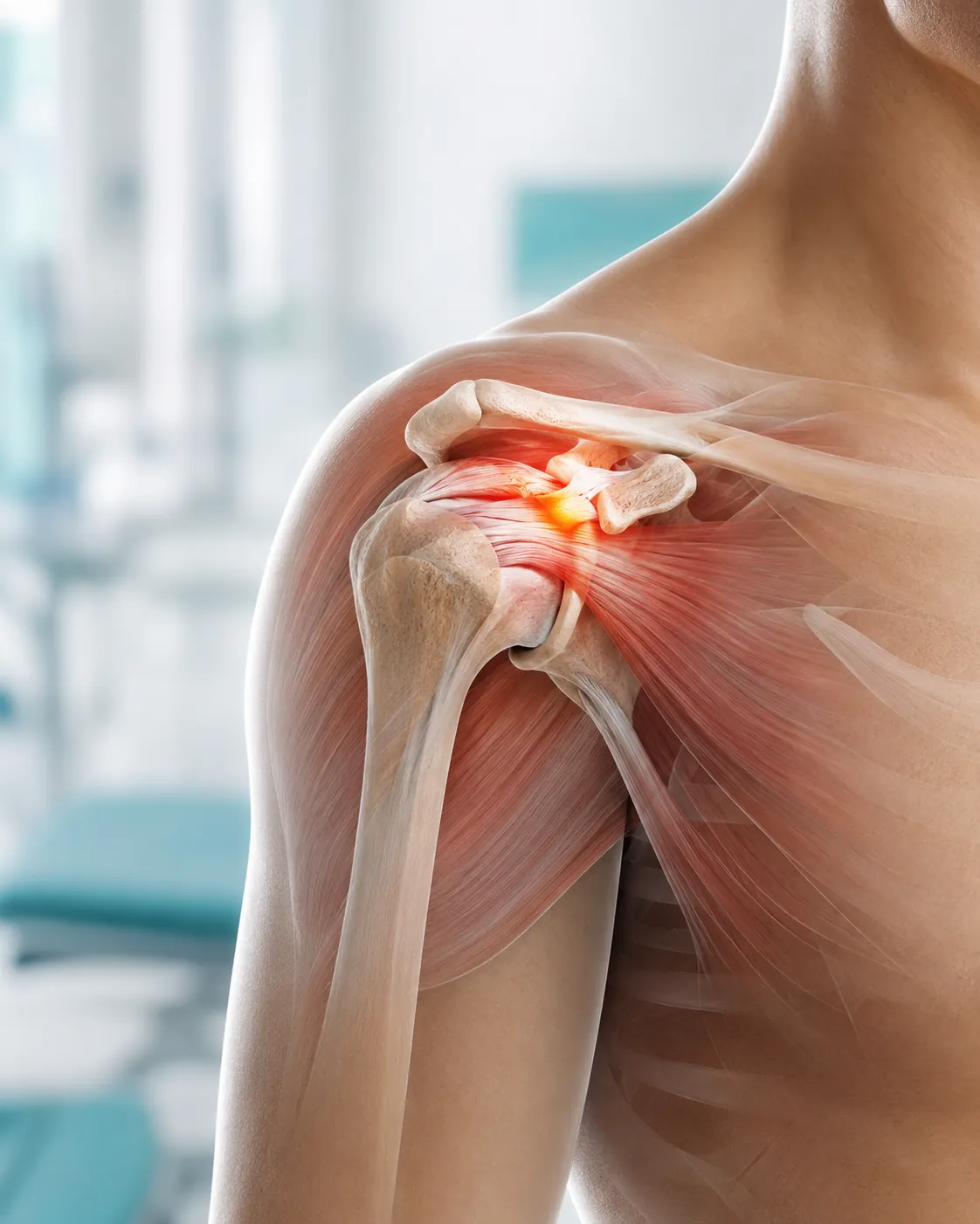 Wizualizacja anatomiczna stawu barkowego z zaznaczonym miejscem bólu
